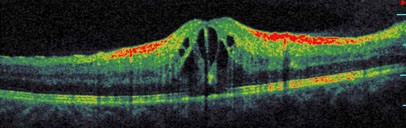 4-oct-spectral-domain