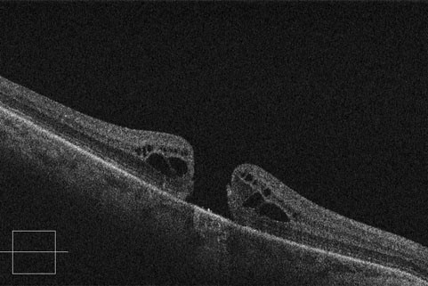 5-oct-spectral-domain